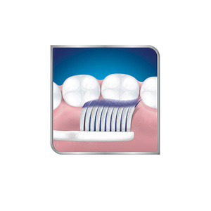 Complete Protection Οδοντόβουρτσα για Ευαίσθητα Δόντια Μαλακή 1τμχ