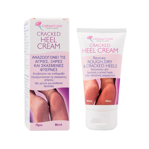 Footcare Cracked Heel Cream - Kρέμα Αναζωογόνησης Για Άγριες Ξηρές & Ταλαιπωρημένες Φτέρνες Με Έλαιο Μέντας 50ml