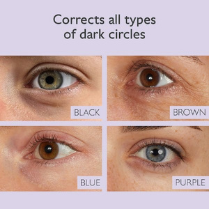 Vinoperfect Brightening Κρέμα Ματιών Για Λάμψη Κατά Των Μαύρων Κύκλων 15ml